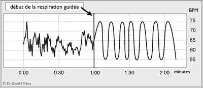 coherence cardiaque graph